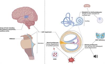 Hearing loss and its link to cognitive impairment and dementia